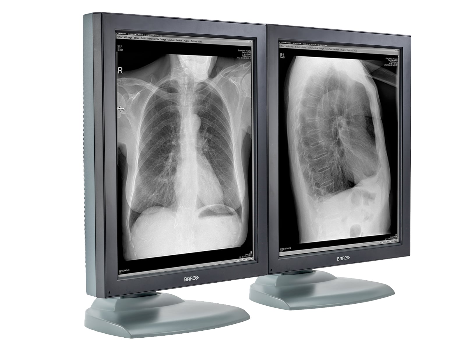 Barco Nio MDNG-2121 2MP 21" Grayscale Medical Diagnostic Radiology Monitor
