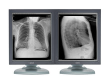 Barco Nio MDNG-2121 Monitor di radiologia diagnostica medica in scala di grigi da 2 MP 21"