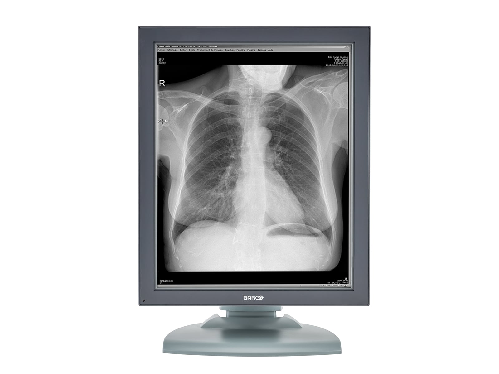 Barco Nio MDNG-2121 2MP 21" Grayscale Medical Diagnostic Radiology Monitor