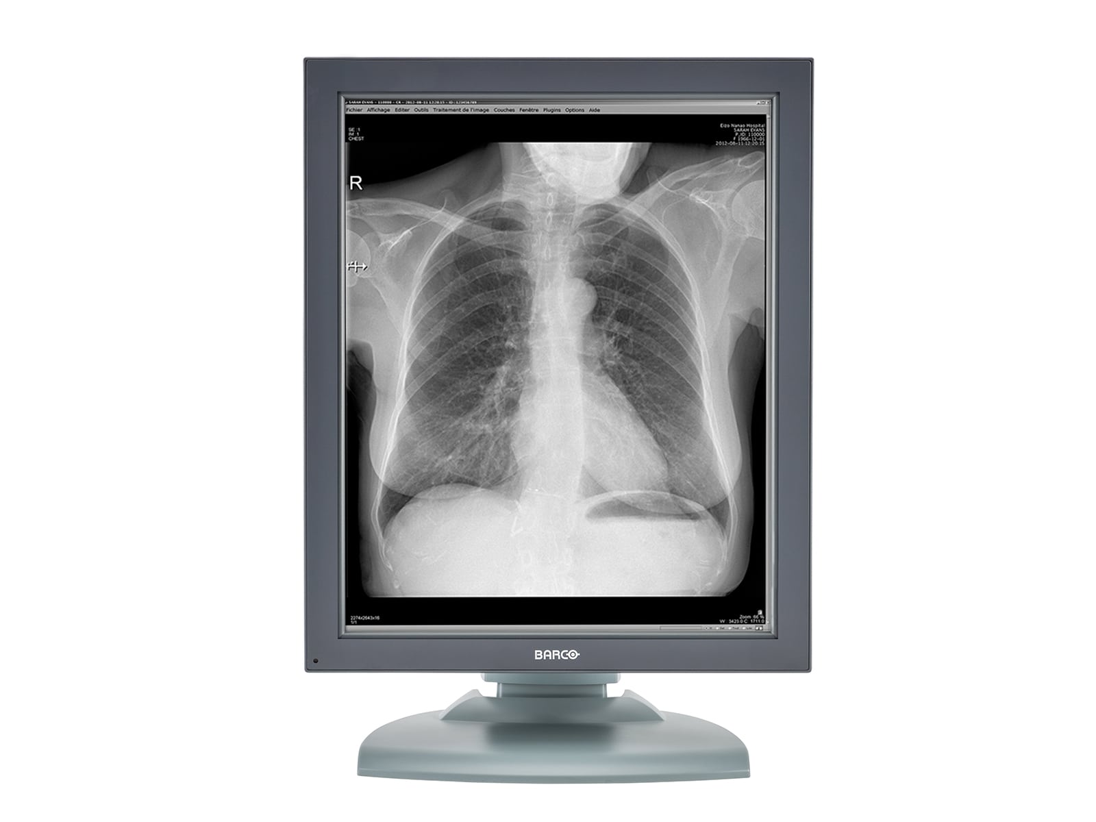 Barco Nio MDNG-2121 2MP 21" Grayscale Medical Diagnostic Radiology Monitor (K9601651) Monitors.com 