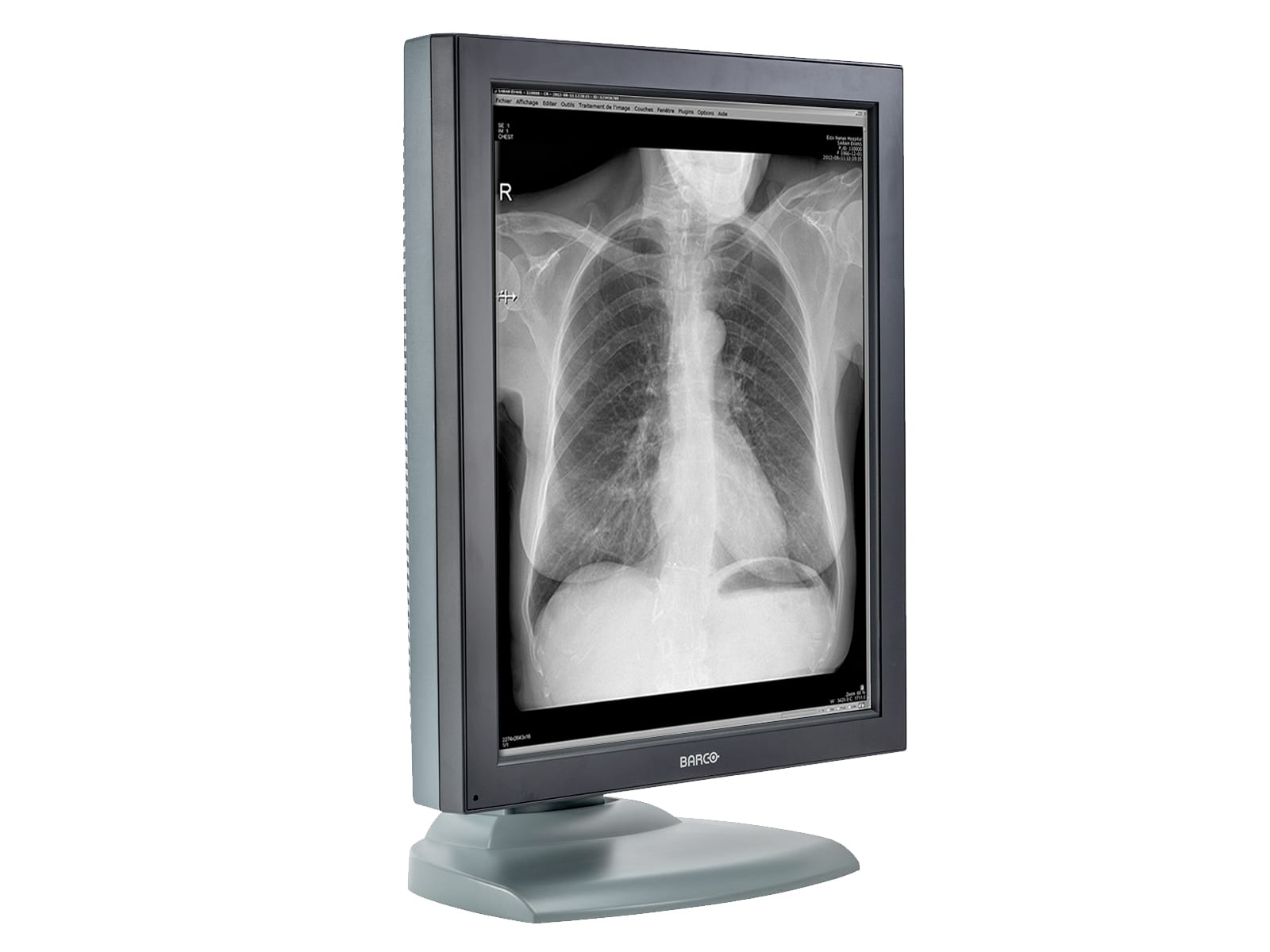 Barco Nio MDNG-2121 2MP 21" Grayscale Medical Diagnostic Radiology Monitor