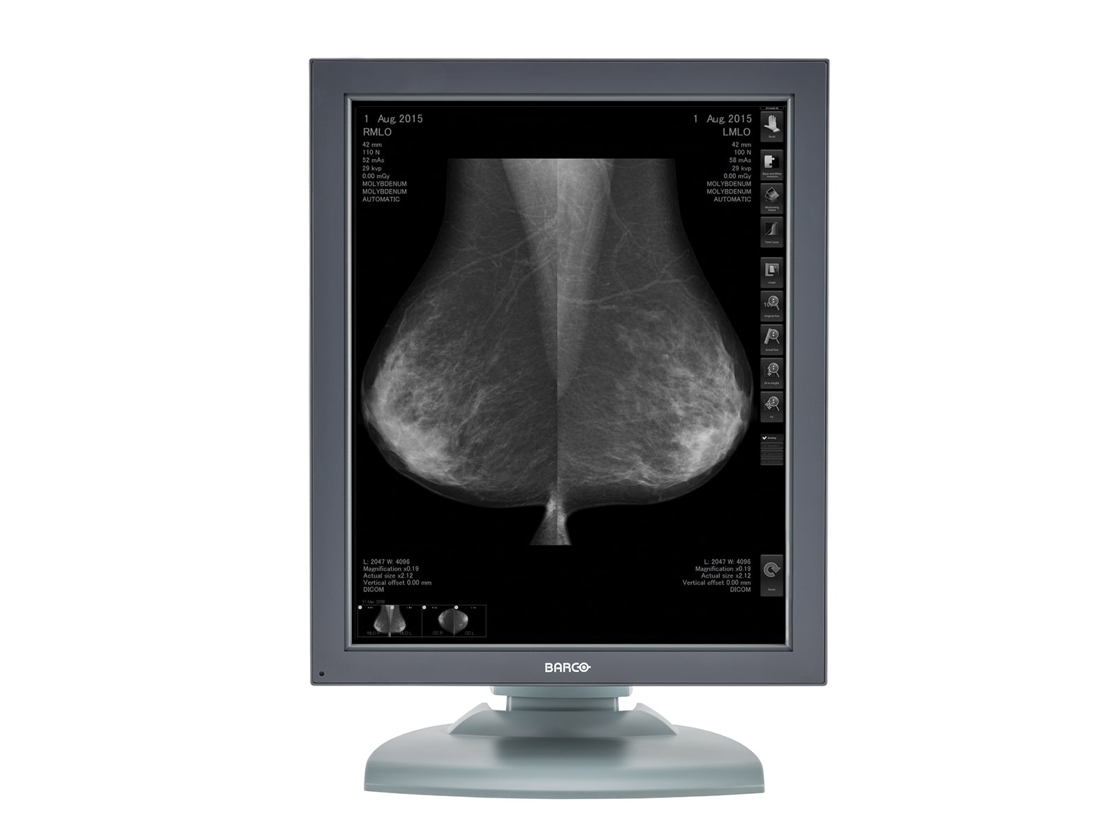 Barco Nio MDNG-5121 Grayscale Mammography Breast Imaging PACS Display (K9601568) Monitors.com 