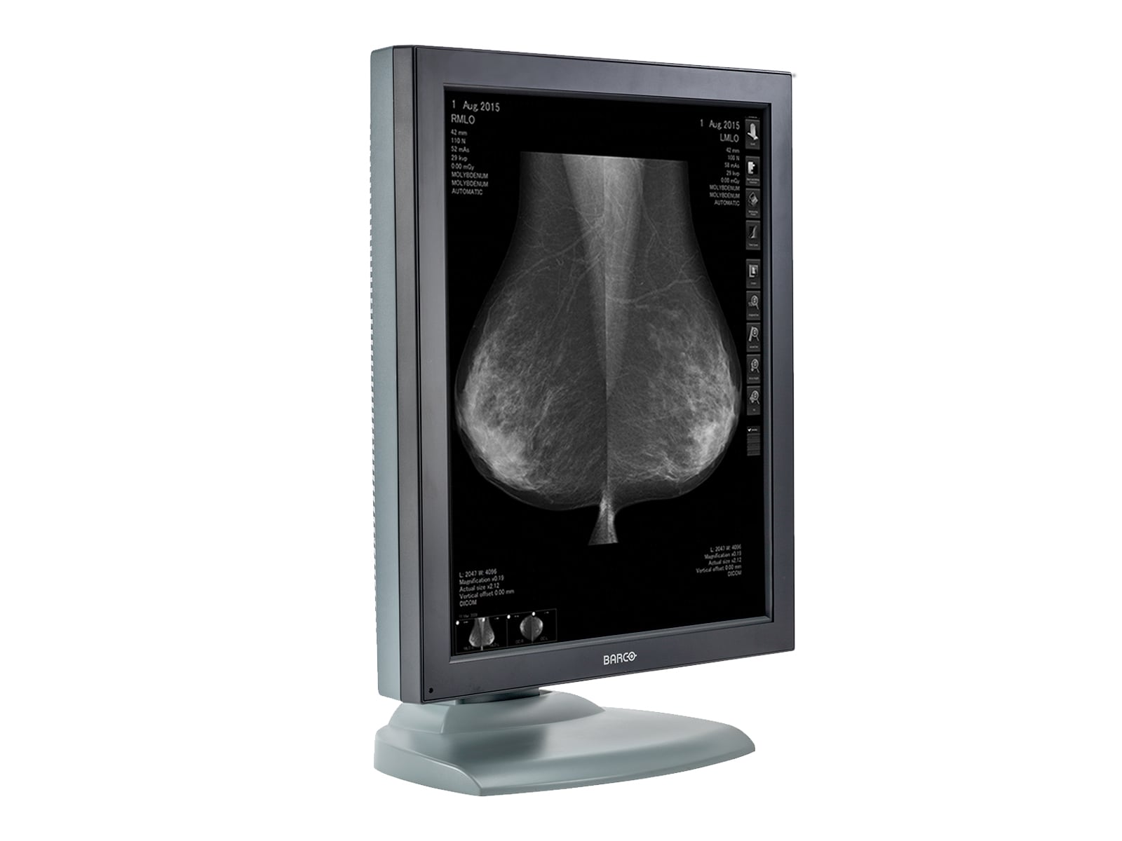 Barco Nio MDNG-5121 Grayscale Mammography Breast Imaging PACS Display (K9601568) Monitors.com 