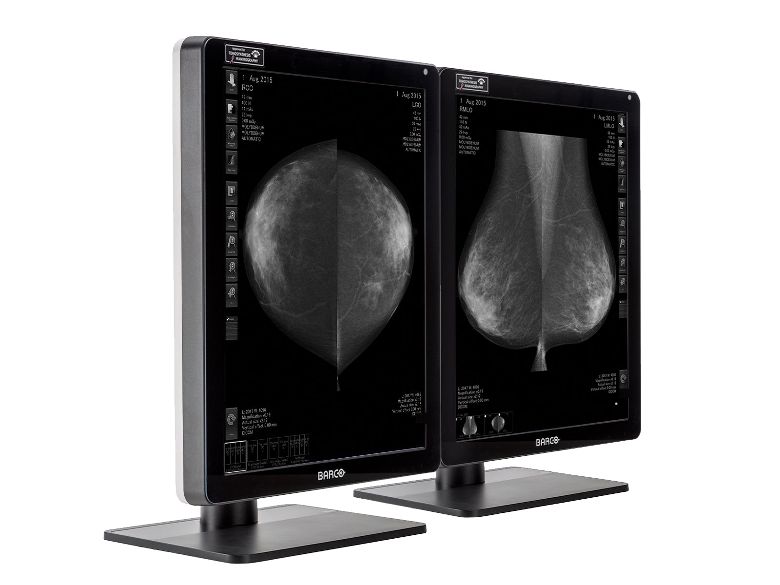 Barco Nio MDNG-6221 5MP 21" Grayscale LED Mammo 3D-DBT Breast Imaging Display (K9300372B)