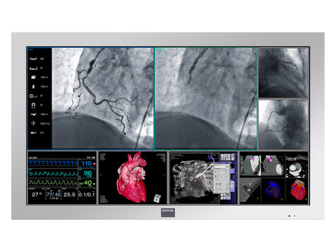 Monitor de Exibição Médica Cirúrgica Colorida Full HD de 42