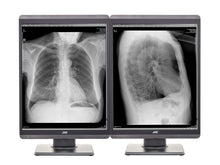 JVC Totoku MS-S200 2MP 21 "Monitor de Exibição de Radiologia Diagnóstica em Escala de Cinza (MS-S200)