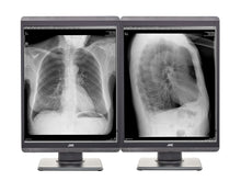 JVC Totoku MS-S300 3MP 21 "LED Escala de Cinza Monitor de Diagnóstico de Radiologia Geral (MS-S300)