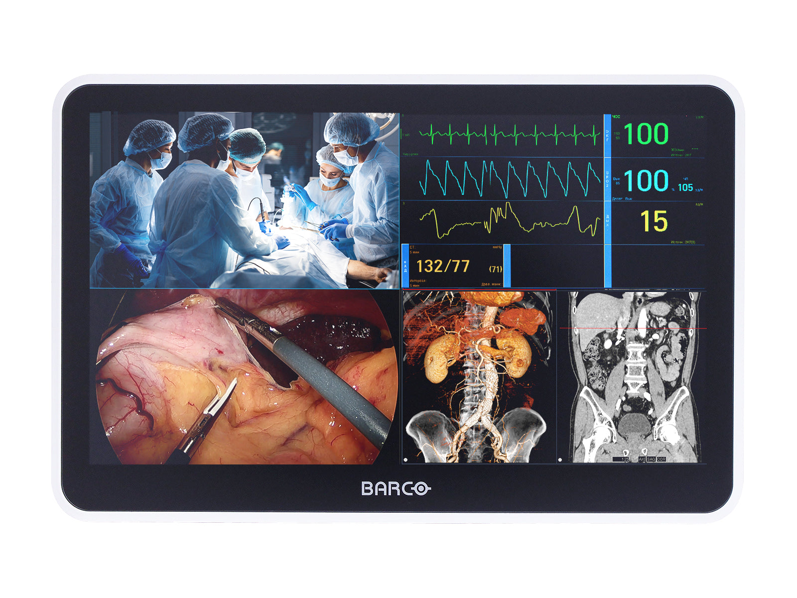 Barco MUIP-2112 12.5" Color Clinical Review Multi-touch Screen Monitor (K9307937)