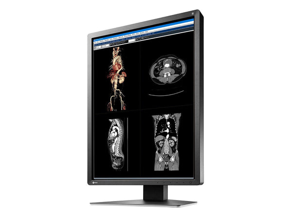 Eizo RadiForce MX216 2MP 21