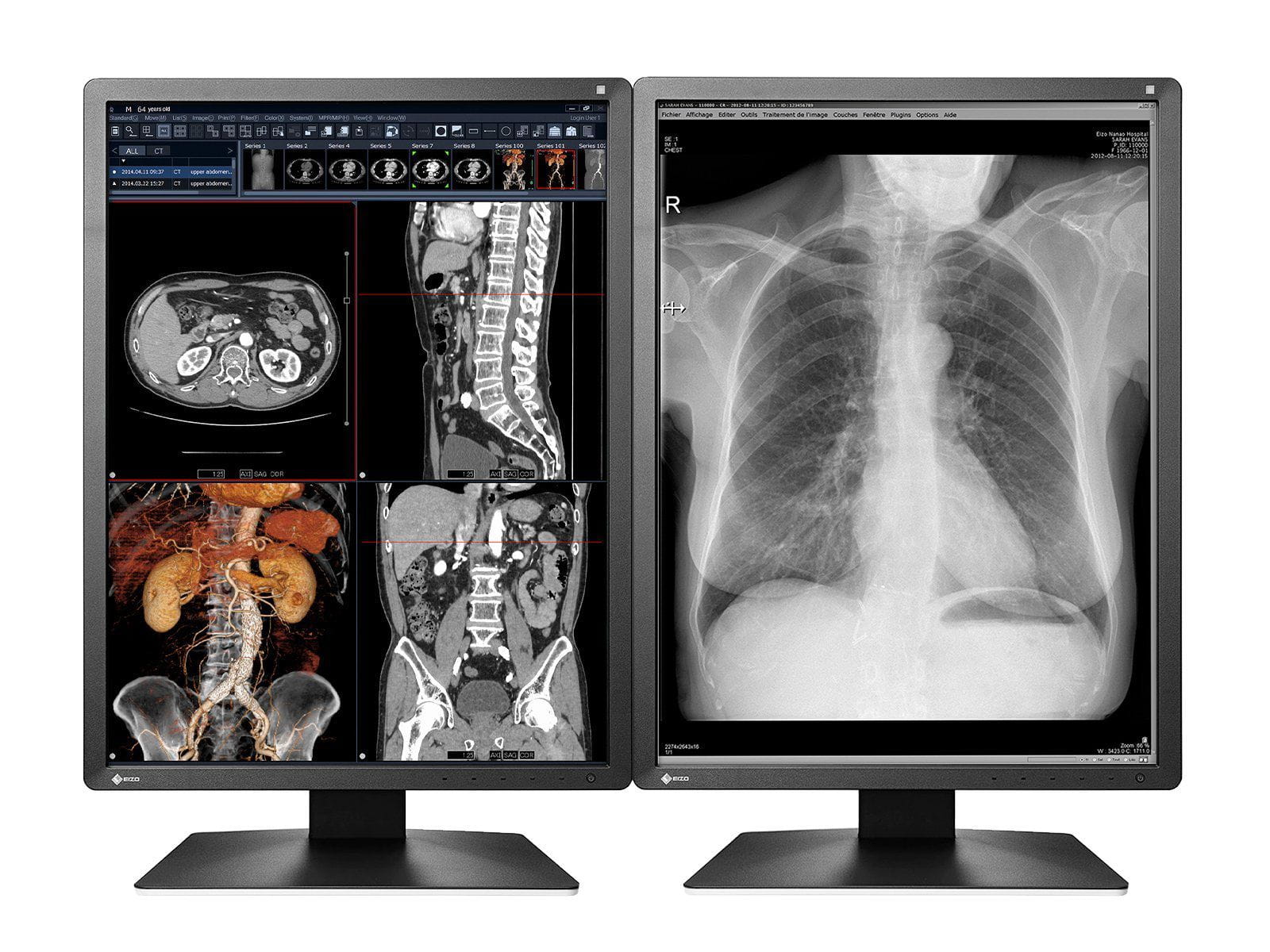 Eizo RadiForce MX216 2MP 21" Color LED Medical Display Monitor (MX216-BK) Monitors.com 