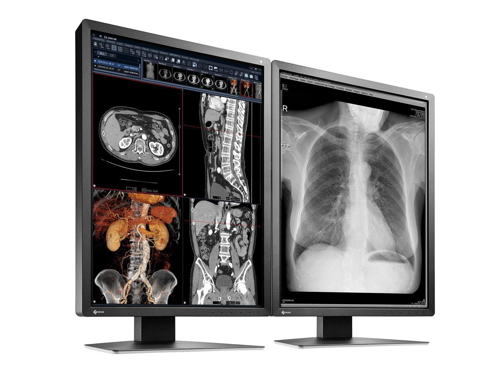 Eizo RadiForce MX216 2MP 21" Color LED Medical Display Monitor (MX216-BK) Monitors.com 