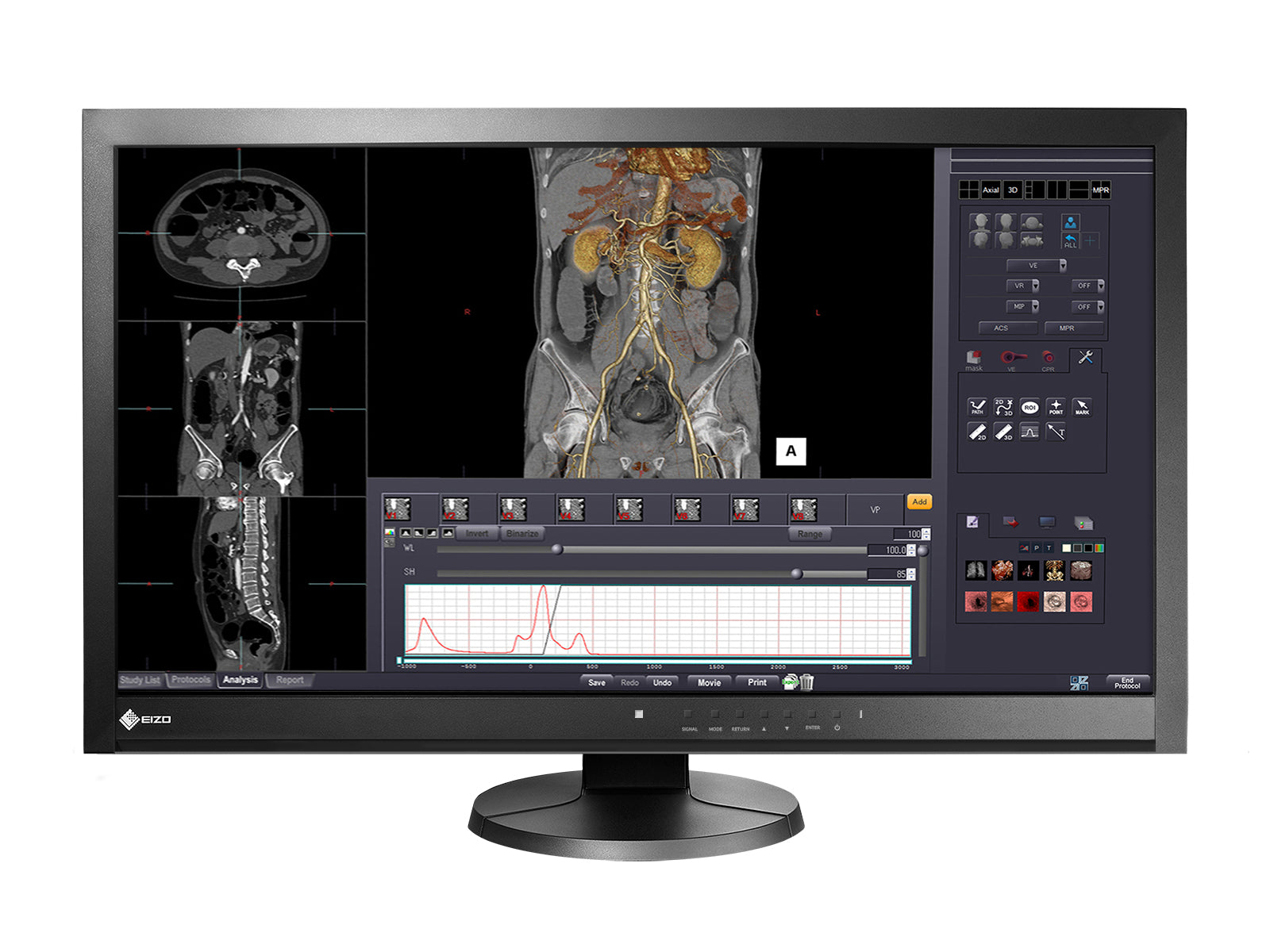 Eizo RadiForce MX270W 3.7MP 27" Color LED Clinical Review Display (MX270W) Monitors.com 