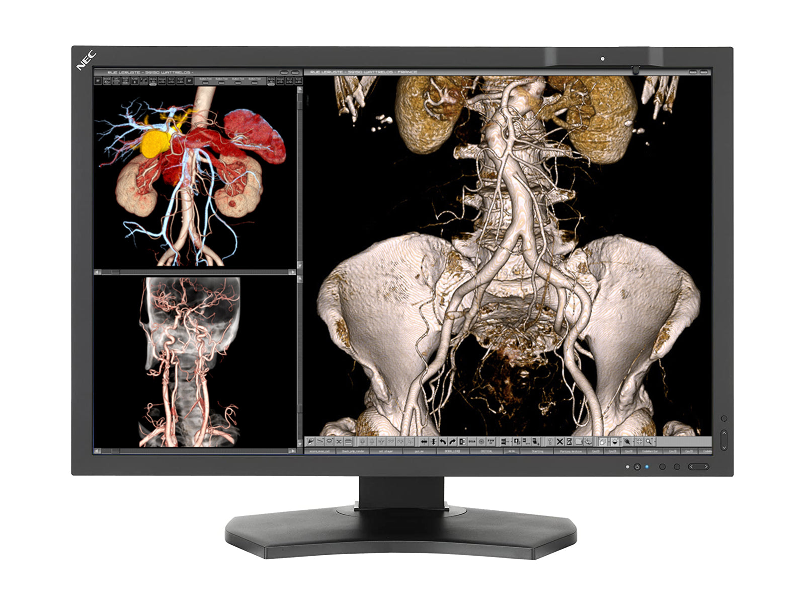 NEC MultiSync MD302C4 4MP 30" General Radiology PACS Display (MD302C4)