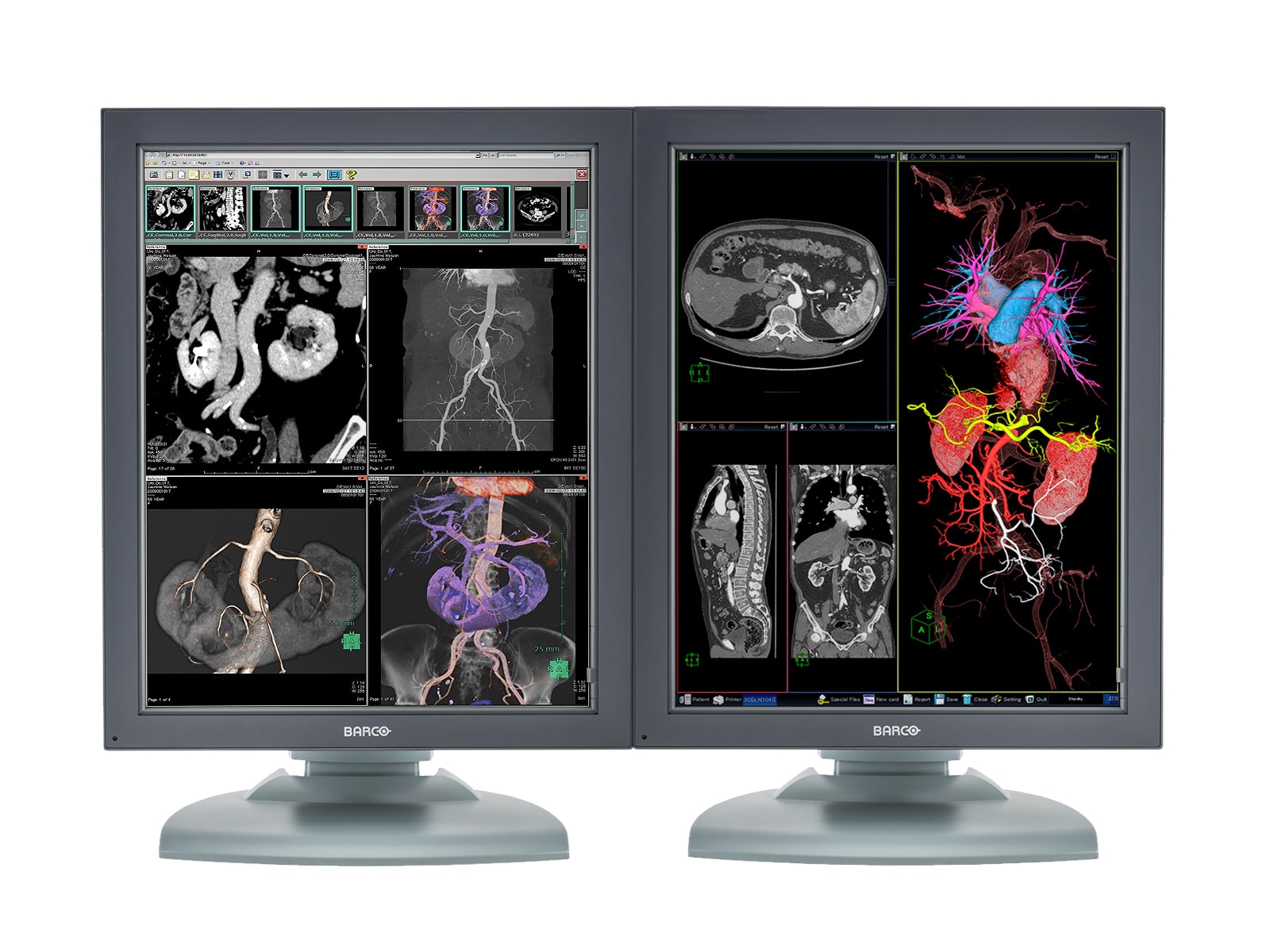 Barco Nio MDNC-3121 HighBright 3MP 21" Color Medical Diagnostic Radiology Monitor
