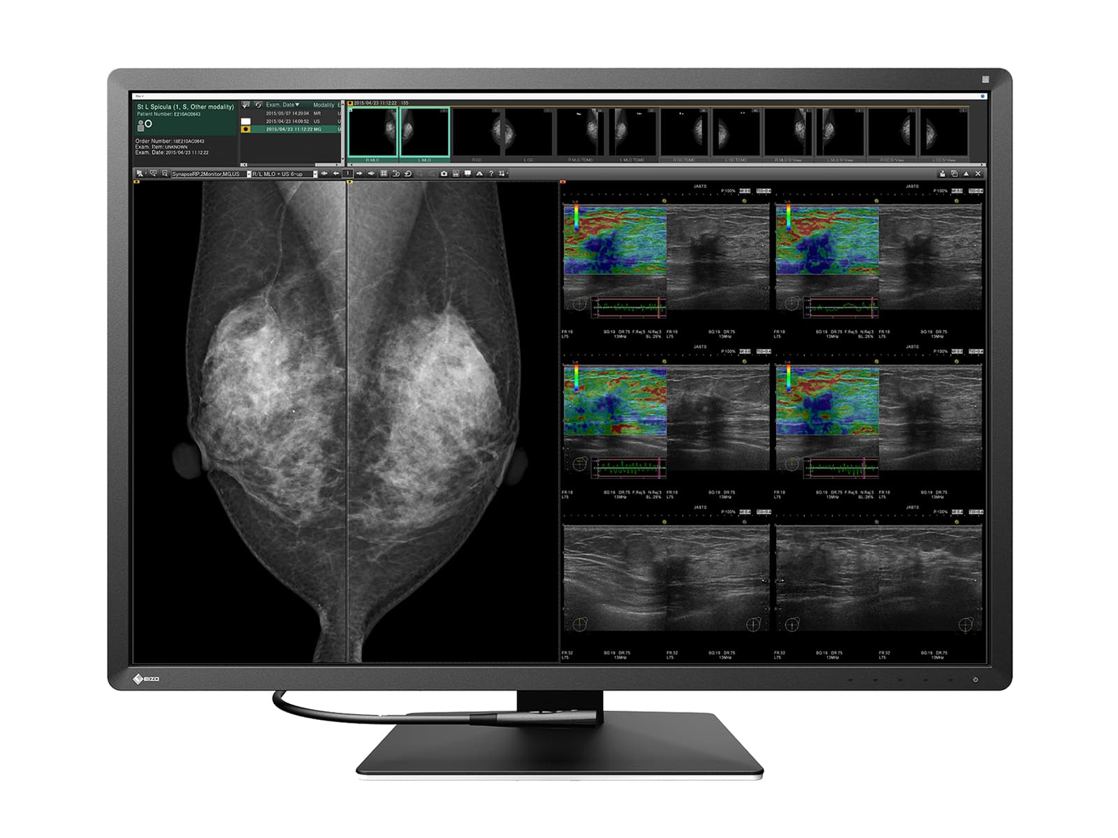 Complete Mammography Reading Station | Eizo Radiforce RX1270 12MP Color Mammo Monitor | HP Z4 G5 Workstation | Dictation Mic | Worklist Monitors (RX1270Z4G5)