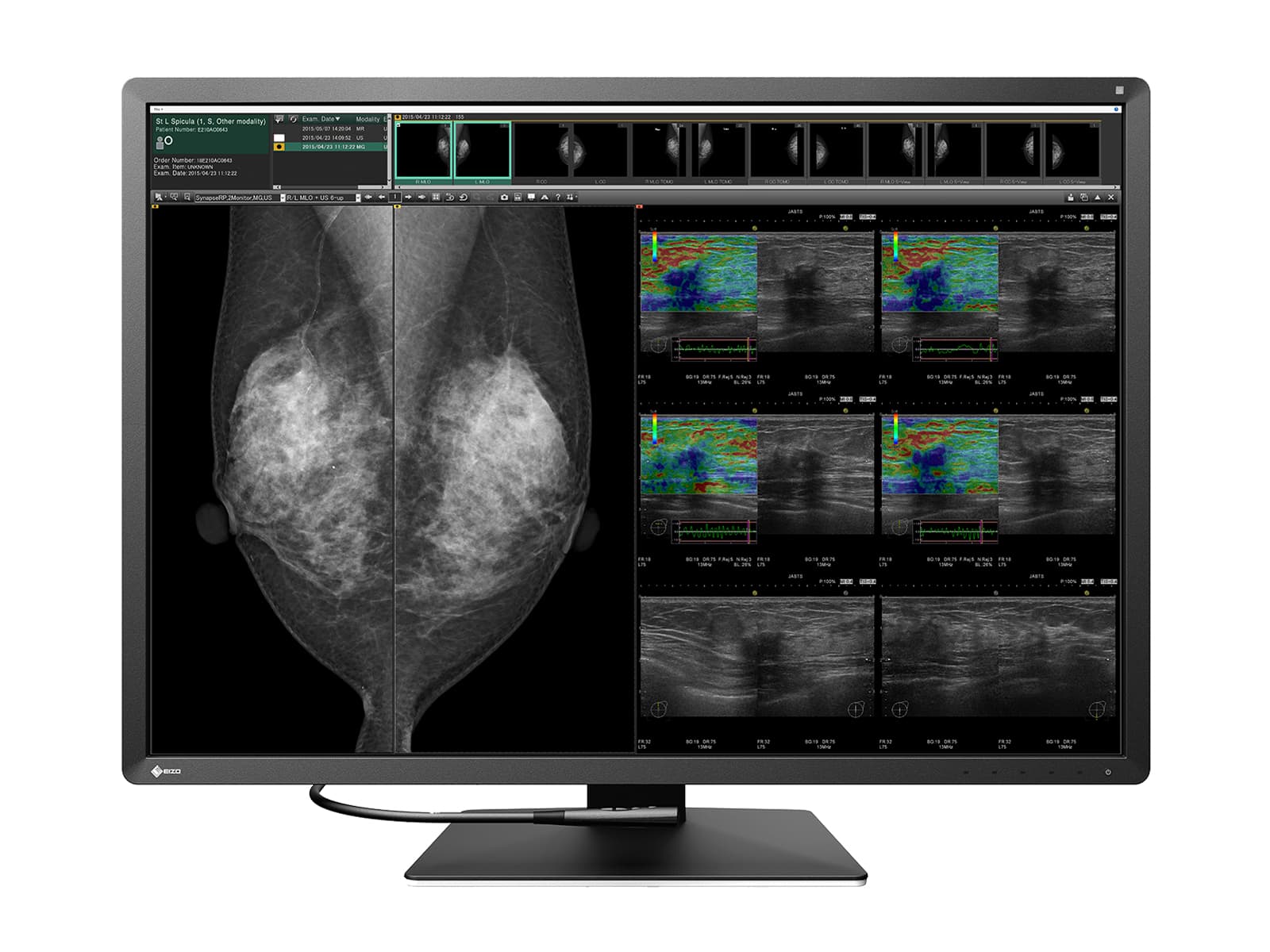 Complete Mammography Reading Station | Eizo Display | Lenovo Workstation (RX1270P520) Monitors.com 
