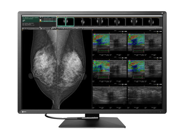 Complete Mammography Reading Station | Eizo Radiforce RX1270 12MP Color Mammo Monitor | HP Z4 G5 Workstation | Dictation Mic | Worklist Monitors (RX1270Z4G5)