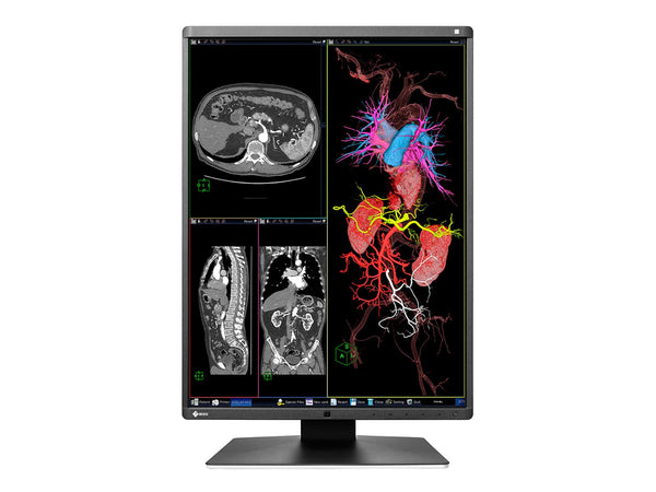 Eizo RadiForce RX350 3MP 21