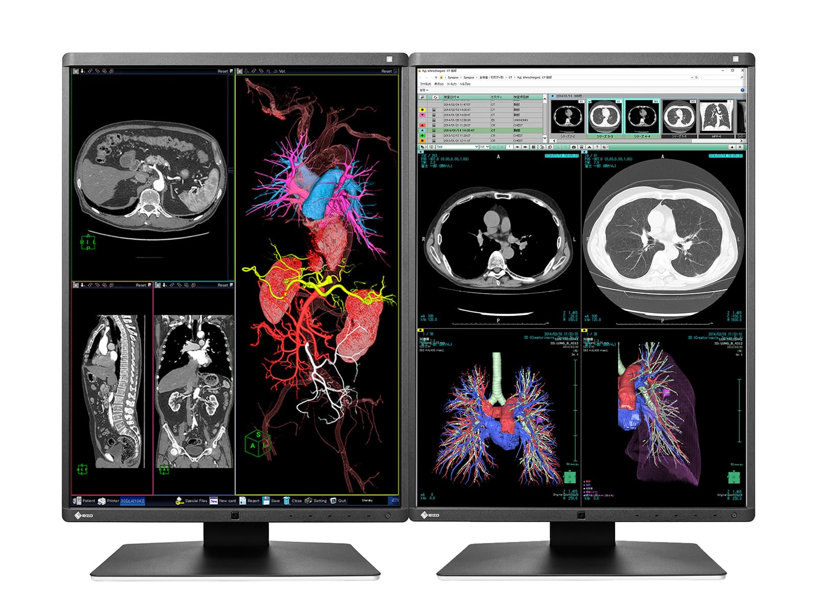 Eizo RadiForce RX360 3MP 21" Color LED General Radiology PACS Display Monitor (RX360) Monitors.com 