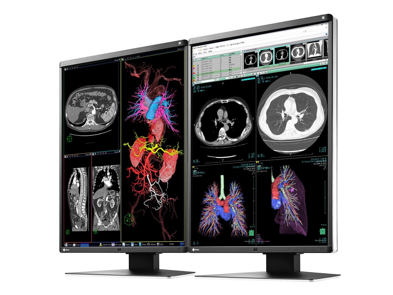 Eizo RadiForce RX360 3MP 21" Color LED General Radiology PACS Display Monitor (RX360) Monitors.com 