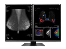 Eizo RadiForce RX560 5MP 21" LED couleur Mammo 3D-DBT Affichage d’imagerie mammaire (RX560-BK)