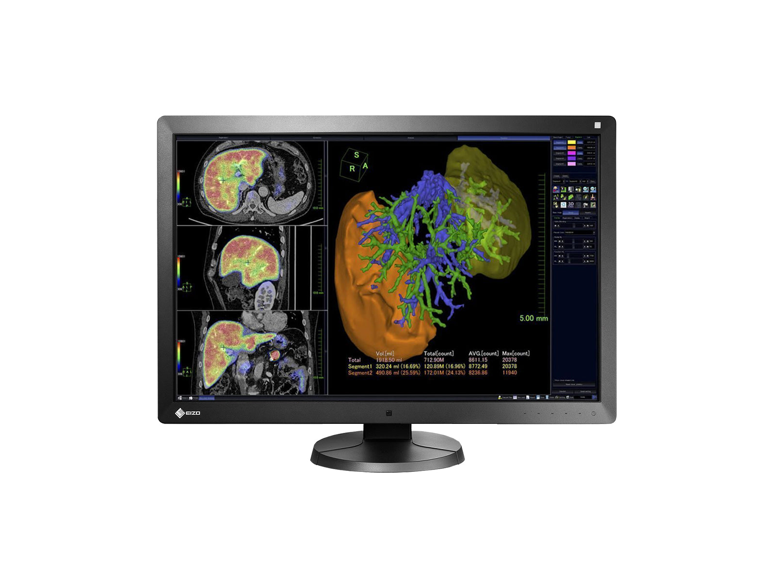 Complete PACS General Radiology Station | Eizo Radiforce RX650 6MP Color LED Display | Lenovo Workstation | Dictation Mic | Worklist Monitor (RX650Z4R)