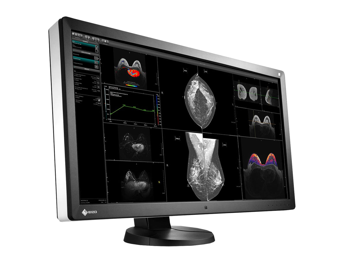 Ar monitoring