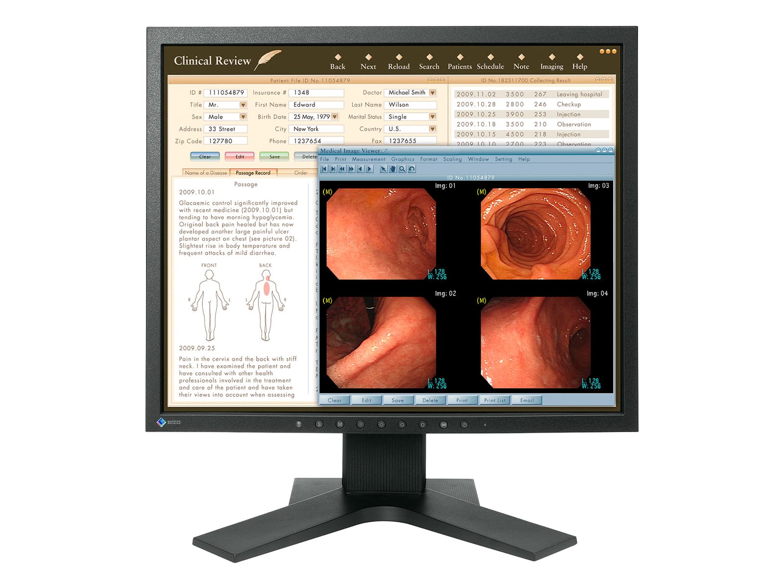 Eizo RadiForce MX191 1MP 19" Color Clinical Review Monitor (MX191) Monitors.com 