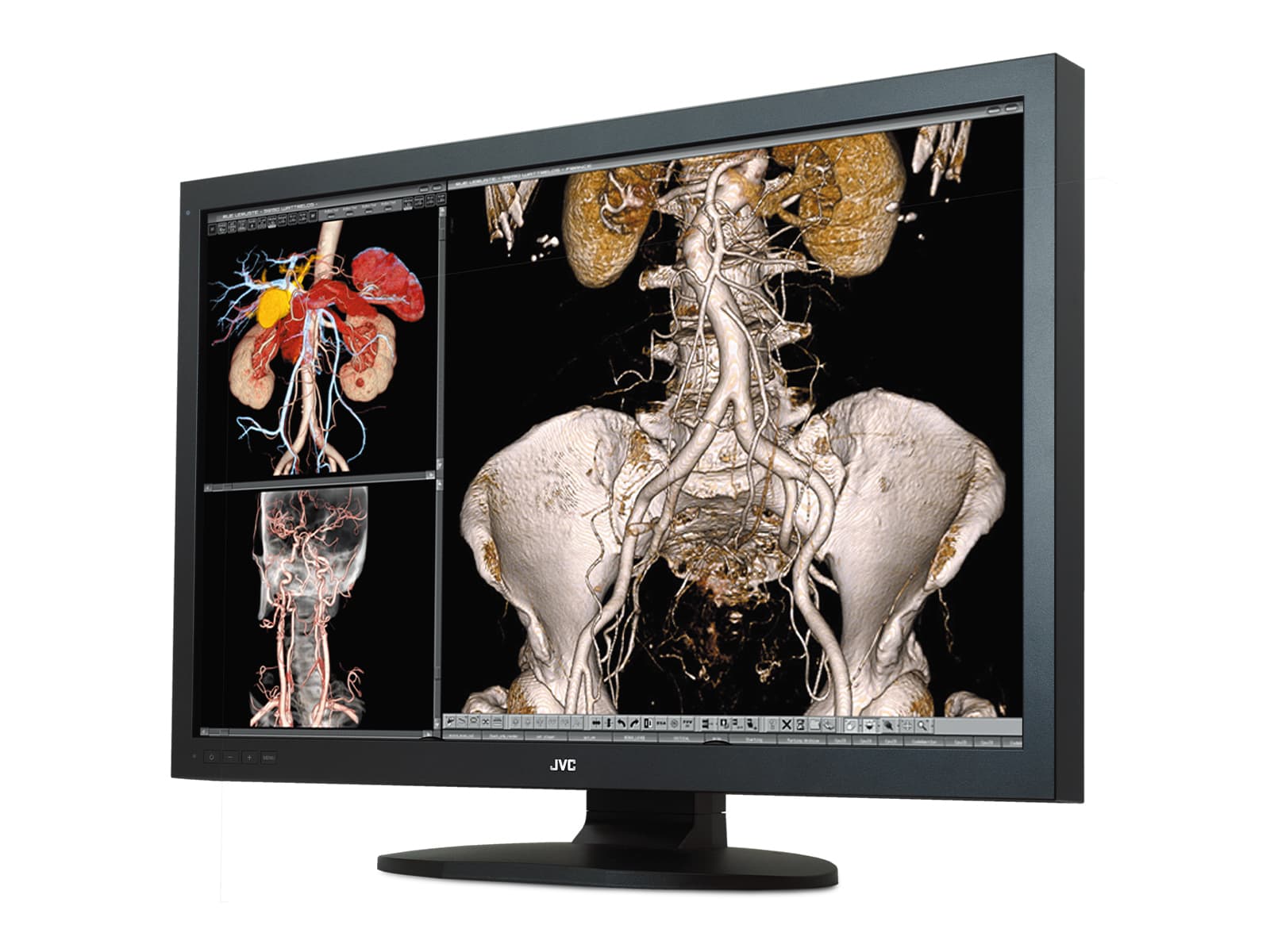 JVC Totoku CCL650i2 6MP LED Color 30" General Radiology Diagnostic Display (CCL650i2) Monitors.com 