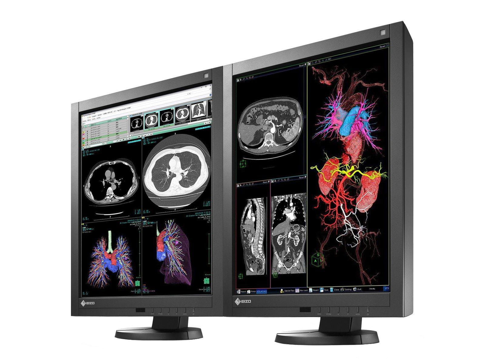 Complete PACS General Radiology Station | Eizo 3MP Color LED Displays | Lenovo Workstation