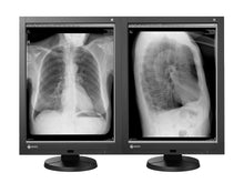 Eizo RadiForce GX340 3MP Moniteur d'affichage diagnostique général en niveaux de gris LED 21" (GX340-CL) 