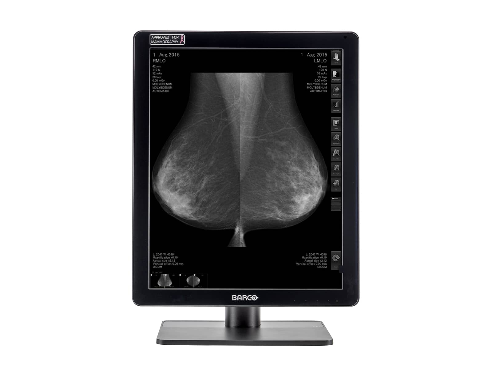 Barco Coronis MDCG-5221 Grayscale LED Mammo 3D-DBT Breast Imaging Display (K9301541A) Monitors.com 