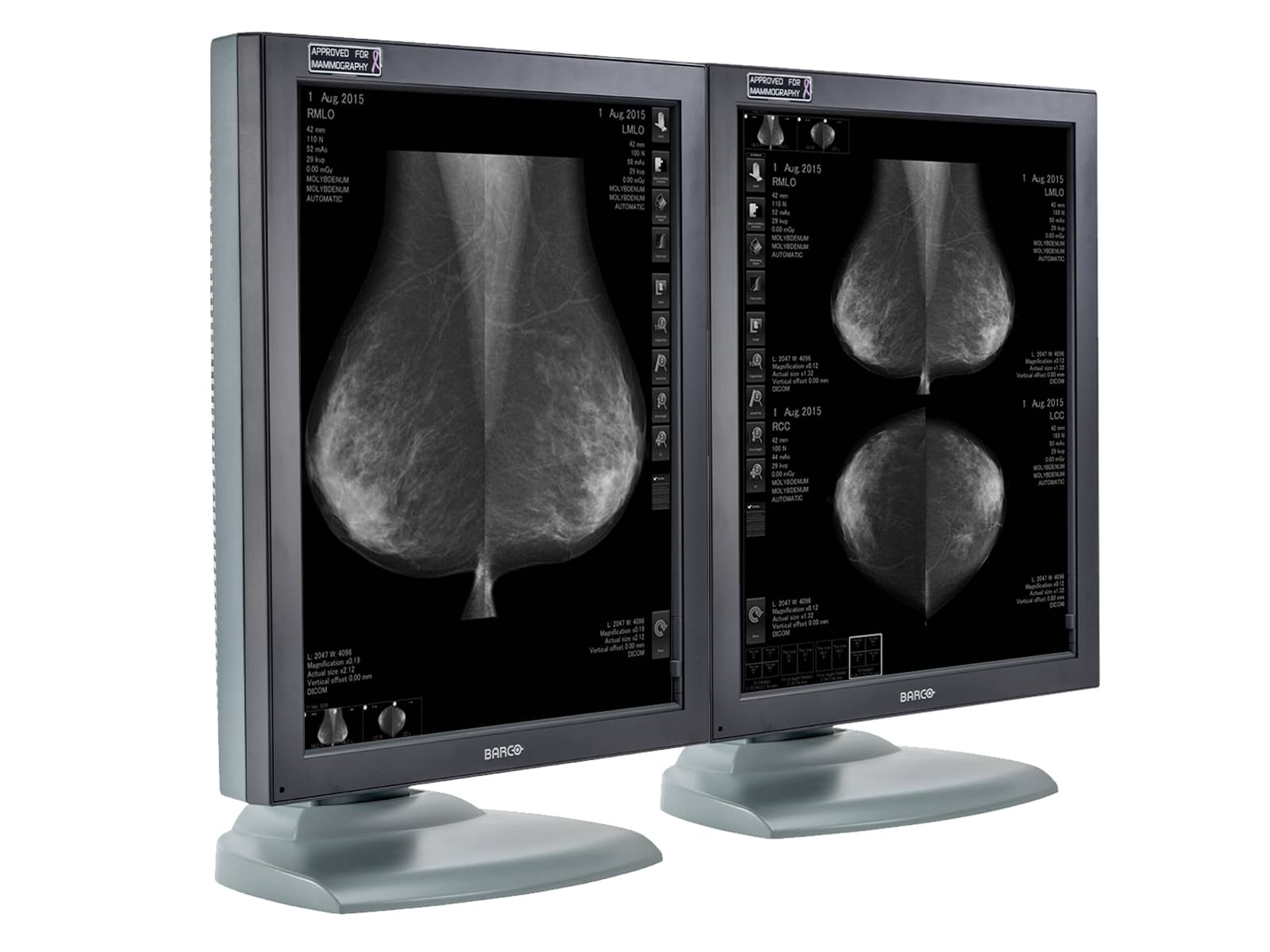 Barco Coronis MDMG-5121 Grayscale Breast Imaging PACS Mammography Display (K9601259) Monitors.com 
