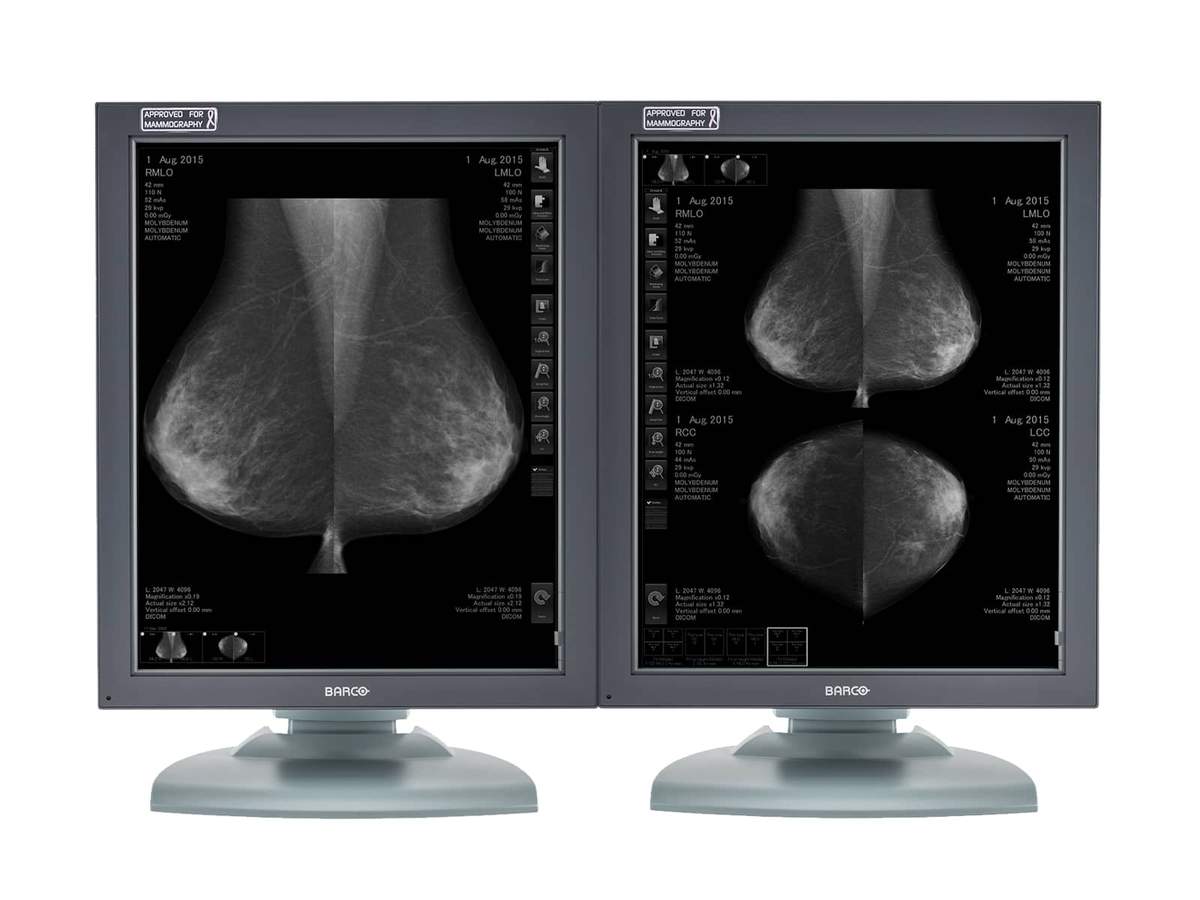 Complete Mammography Reading Station | Barco 5MP Displays | HP Workstation 5121T5820R Monitors.com 