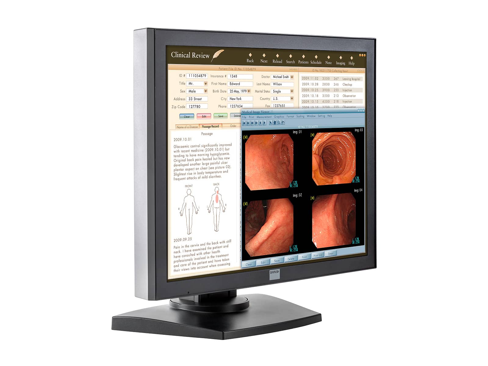 Barco MDRC-1119-TS 1MP 19" Touchscreen Color Clinical Review Display (K9301801A) Monitors.com 
