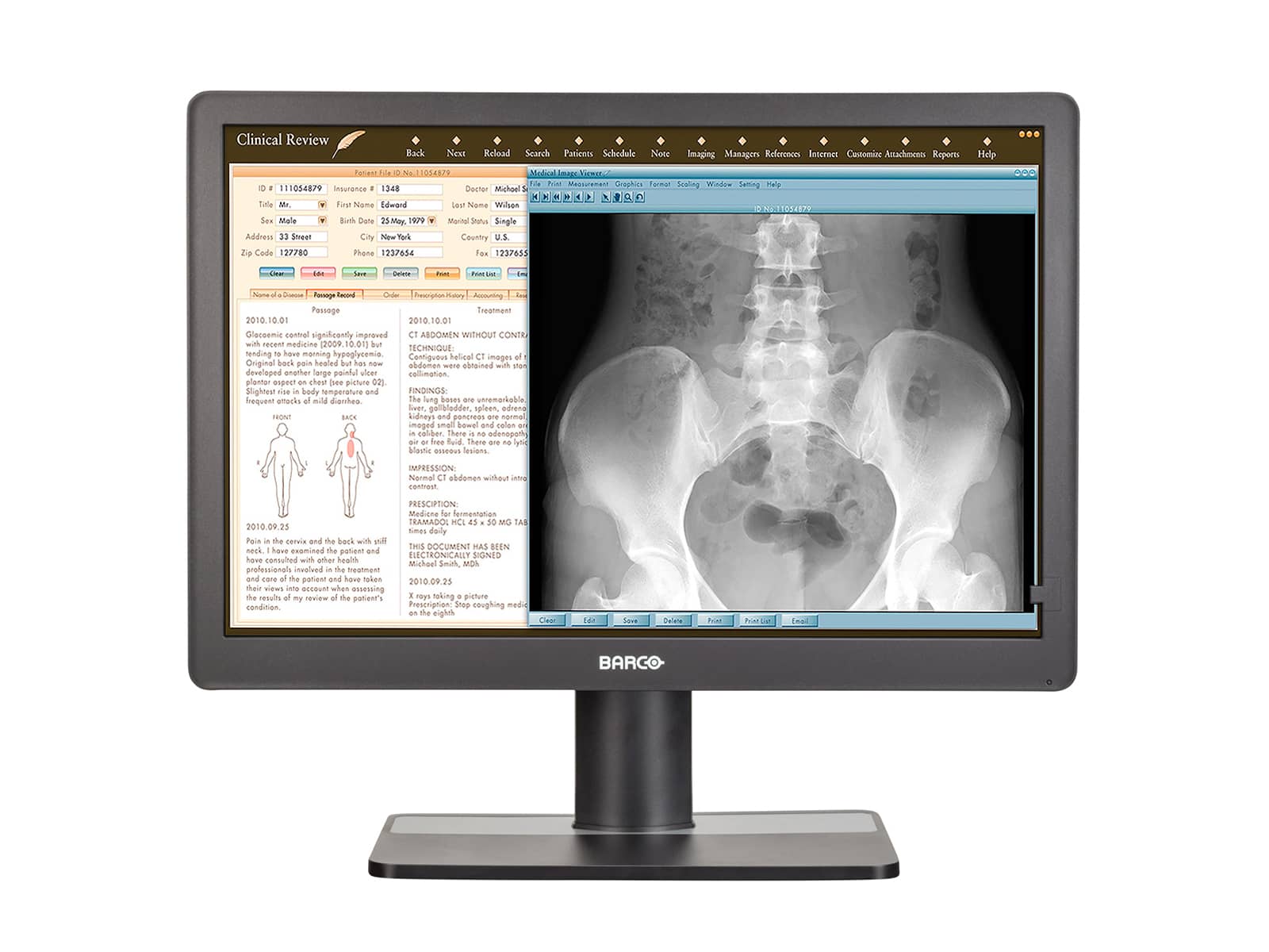 Barco Eonis MDRC-2222 Full HD 1080P 22" Clinical Review LED Monitor (K9307944) Monitors.com 