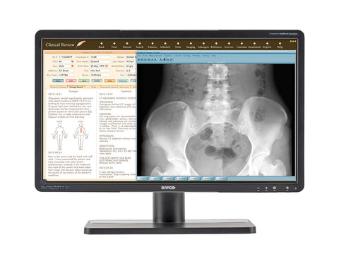 Monitor de Revisão Clínica LED Colorido Barco Eonis MDRC-2224 WUXGA 24