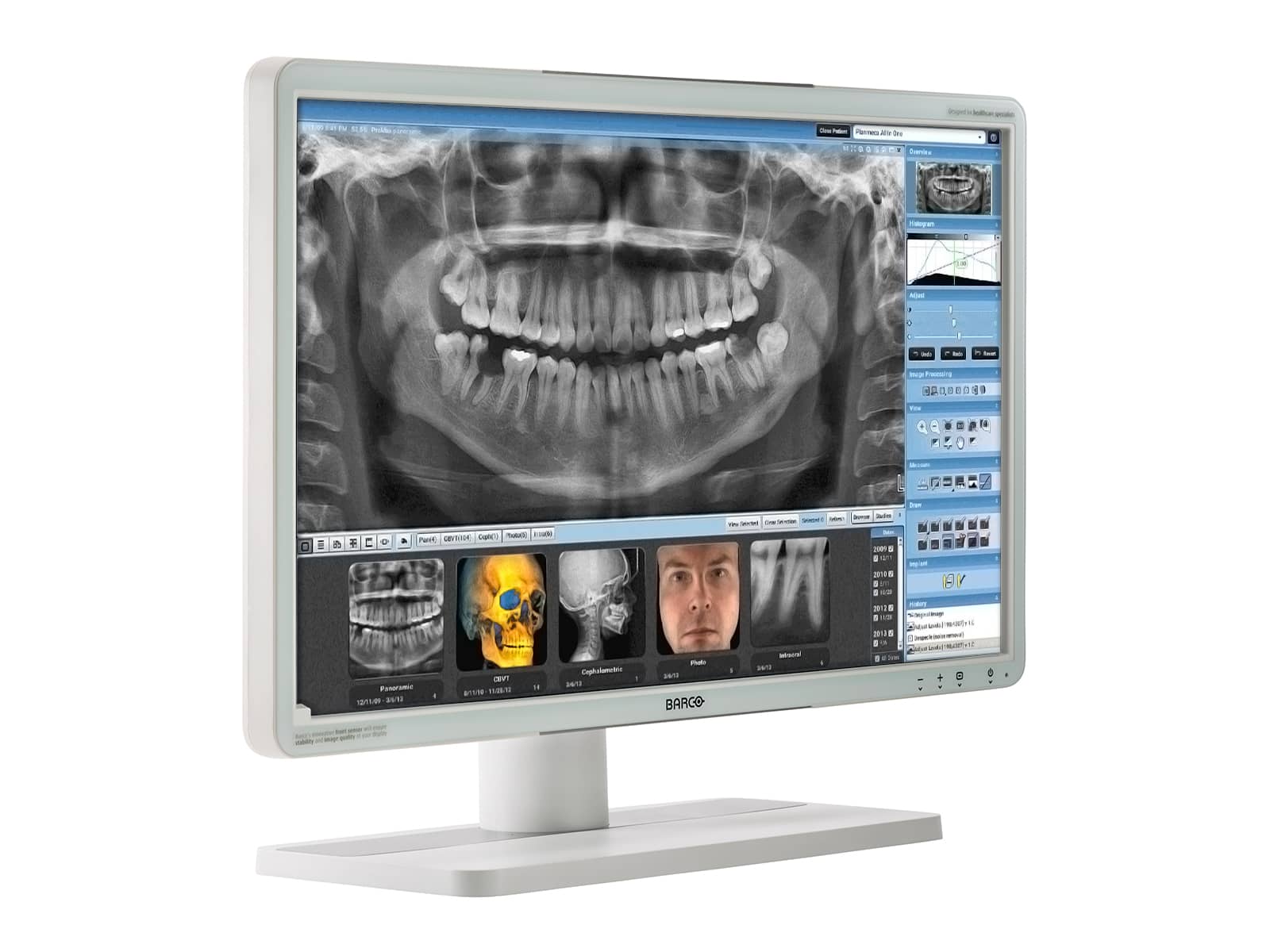 Barco Eonis MDRC-2224 MKII 2MP 24" Color LED Clinical Review Display (K9301806A) Monitors.com 