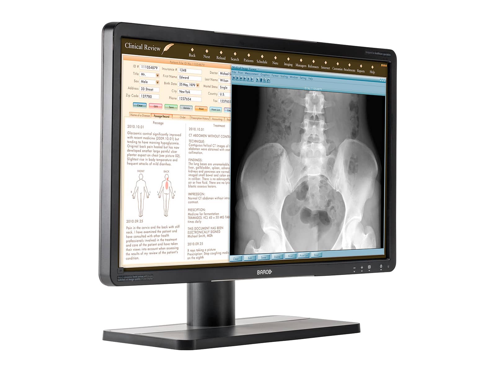 Barco Eonis MDRC-2224 2MP 24" Color LED Clinical Review Display Monitor (K9303005A) Monitors.com 