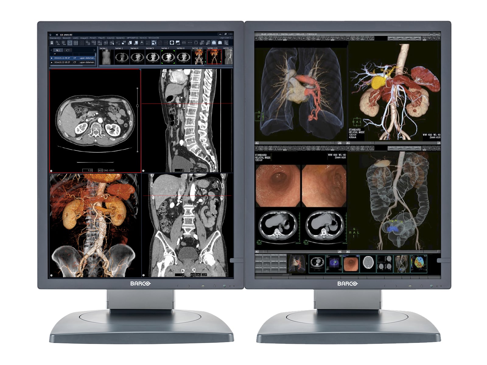 Barco Coronis MDCC-2121 2MP 21" Color Diagnostic Radiology Display Monitor (K9601655) Monitors.com 
