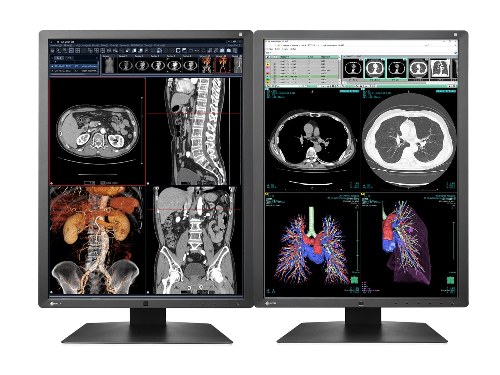 Eizo RadiForce RX250 2MP 21" Color LED Medical Diagnostic Radiology Display Monitor (RX250-BK)  