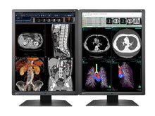 Eizo RadiForce RX250 2MP 21" LED Color Monitor de Radiología de Diagnóstico Médico (RX250-BK)