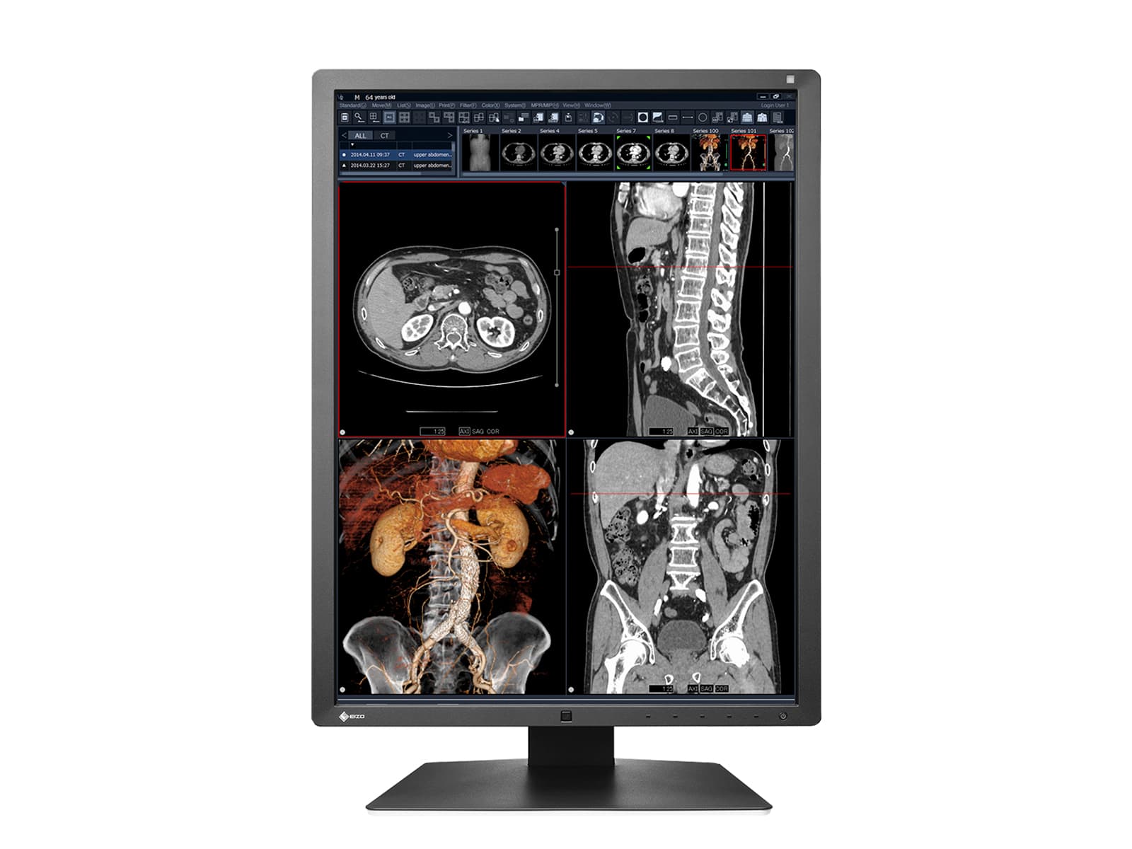 Eizo RadiForce RX250 2MP 21" Color LED Medical Diagnostic Radiology Display Monitor (RX250-BK) 