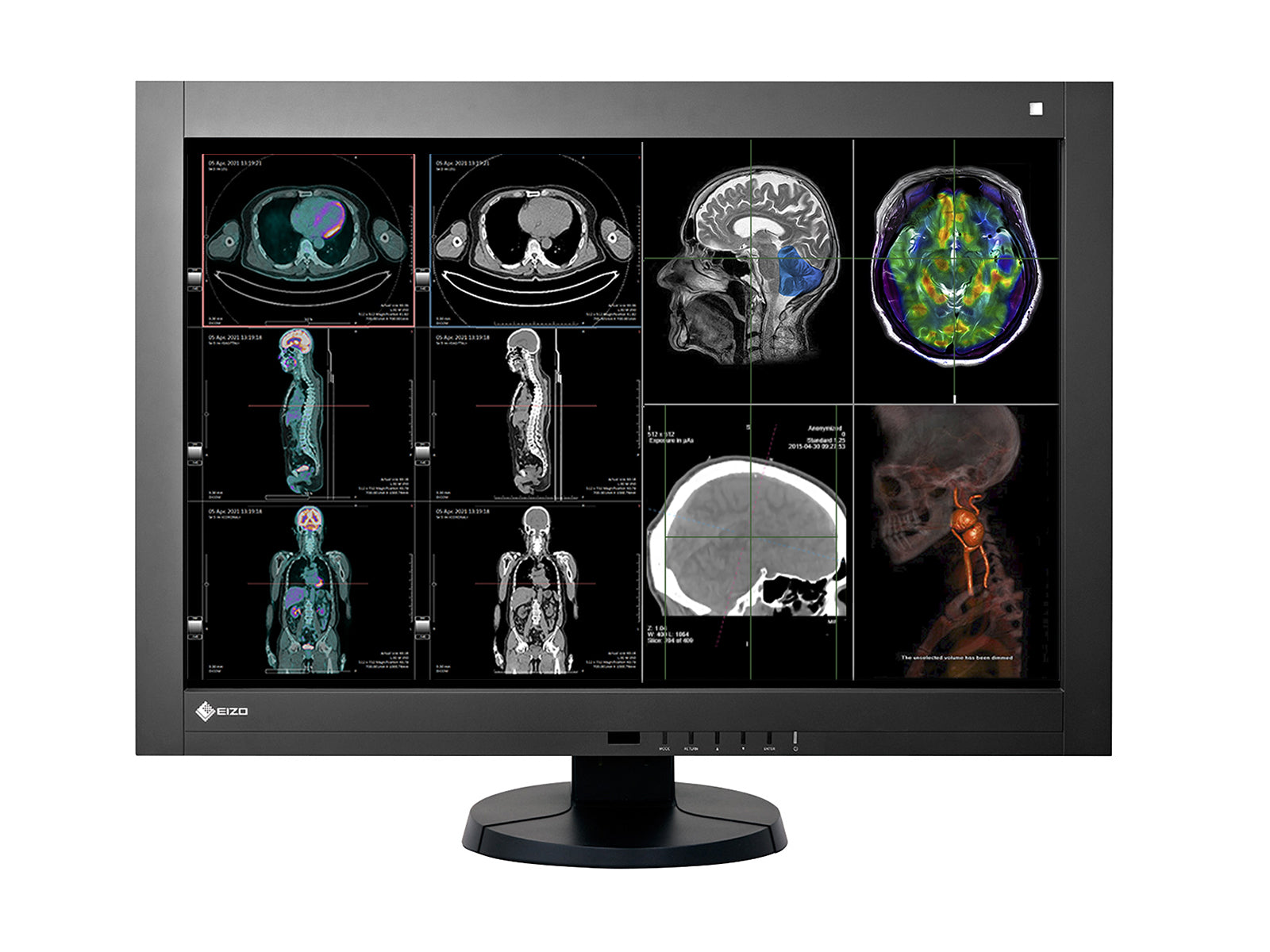 Complete PACS General Radiology Station | Eizo Radiforce RX440 4MP Color LED Displays | Lenovo Workstation | Dictation Mic | Worklist Monitor (RX440Z4R)