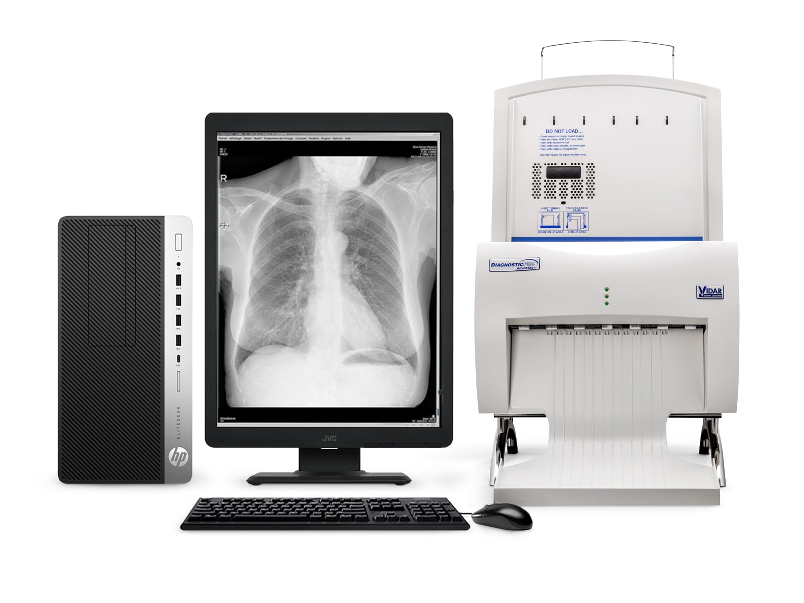 Vidar DiagnosticPro Advantage General Radiology & Mammography Film Digitizer (16333-004)